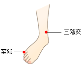 逆子治療