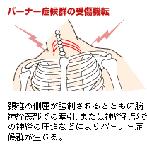 バーナー症候群