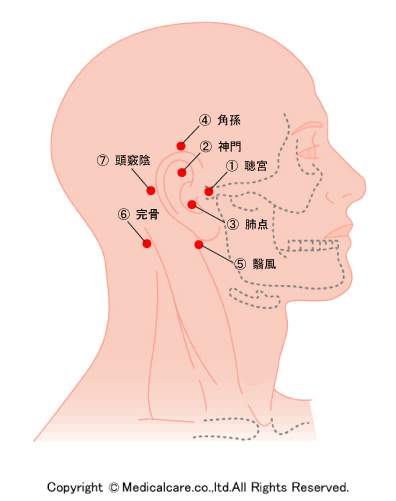 耳鳴り治療のつぼ
